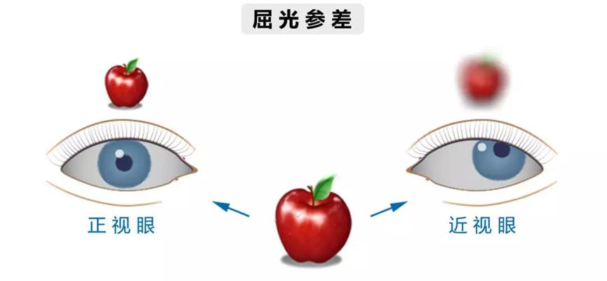 bc2d888937622993ad7ae964832025ca_UCV542419611.png