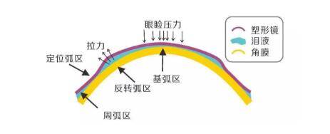 6d7c480b43bef26076cc7e12e111536e_2c57107272f846fd8e5784df8806b9c2.jpeg