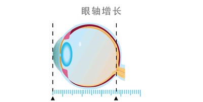 1a787a3633f7b75e627d357d3b022bf4_640_wx_fmt=gif&wxfrom=5&wx_lazy=1.gif