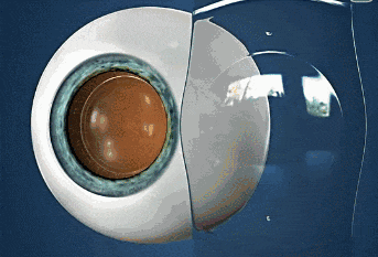 d47026c9948c59e8ab5d69b7c1f52595_640_wx_fmt=gif&wxfrom=5&wx_lazy=1.gif